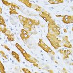 CYP2E1 Antibody in Immunohistochemistry (Paraffin) (IHC (P))