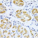 CYP2E1 Antibody in Immunohistochemistry (Paraffin) (IHC (P))