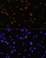 PLCG2 Antibody in Immunocytochemistry (ICC/IF)