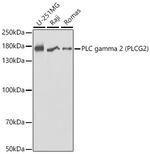 PLCG2 Antibody in Western Blot (WB)