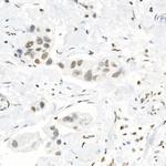 H3K4me3 Antibody in Immunohistochemistry (Paraffin) (IHC (P))