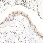 H3K4me3 Antibody in Immunohistochemistry (Paraffin) (IHC (P))