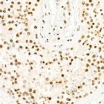 H3K27me3 Antibody in Immunohistochemistry (Paraffin) (IHC (P))