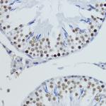 H4K20me2 Antibody in Immunohistochemistry (Paraffin) (IHC (P))