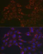 SERPINH1 Antibody in Immunocytochemistry (ICC/IF)