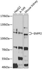 ENPP2 Antibody in Western Blot (WB)