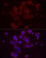 DKK3 Antibody in Immunocytochemistry (ICC/IF)