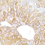 CYP3A4 Antibody in Immunohistochemistry (Paraffin) (IHC (P))