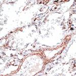 Vimentin Antibody in Immunohistochemistry (Paraffin) (IHC (P))