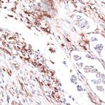 Vimentin Antibody in Immunohistochemistry (Paraffin) (IHC (P))