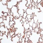 Vimentin Antibody in Immunohistochemistry (Paraffin) (IHC (P))