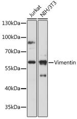 Vimentin Antibody in Western Blot (WB)