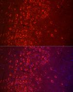 APLP1 Antibody in Immunohistochemistry (Paraffin) (IHC (P))