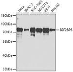 IGF2BP3 Antibody in Western Blot (WB)