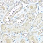 VCP Antibody in Immunohistochemistry (Paraffin) (IHC (P))