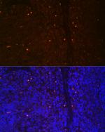 RUNX2 Antibody in Immunocytochemistry (ICC/IF)