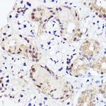 RUNX2 Antibody in Immunohistochemistry (Paraffin) (IHC (P))