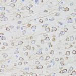 Aquaporin 0 Antibody in Immunohistochemistry (Paraffin) (IHC (P))