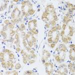 Aquaporin 0 Antibody in Immunohistochemistry (Paraffin) (IHC (P))