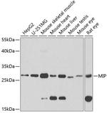 Aquaporin 0 Antibody in Western Blot (WB)