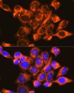 DAP5 Antibody in Immunocytochemistry (ICC/IF)