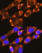 DAP5 Antibody in Immunocytochemistry (ICC/IF)