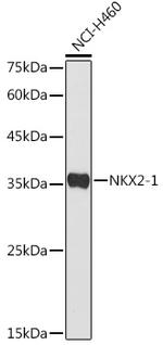 Nkx2.1 Antibody in Western Blot (WB)