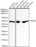 NSE Antibody in Western Blot (WB)