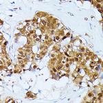 Ubiquitin C Antibody in Immunohistochemistry (Paraffin) (IHC (P))