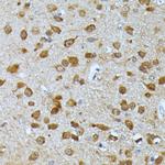 Ubiquitin C Antibody in Immunohistochemistry (Paraffin) (IHC (P))