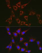 SLC25A6 Antibody in Immunocytochemistry (ICC/IF)