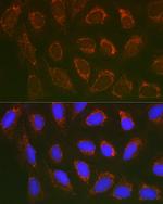 SLC25A6 Antibody in Immunocytochemistry (ICC/IF)