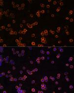 CD39 Antibody in Immunocytochemistry (ICC/IF)