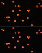 CD39 Antibody in Immunocytochemistry (ICC/IF)