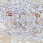 CD39 Antibody in Immunohistochemistry (Paraffin) (IHC (P))