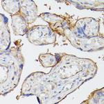 CD39 Antibody in Immunohistochemistry (Paraffin) (IHC (P))