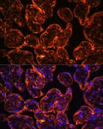 CD39 Antibody in Immunohistochemistry (Paraffin) (IHC (P))