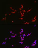 Glutaminase Antibody in Immunocytochemistry (ICC/IF)