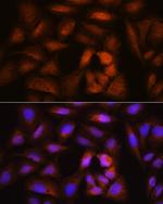 NCAPH Antibody in Immunocytochemistry (ICC/IF)