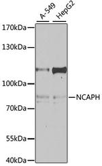 NCAPH Antibody in Western Blot (WB)