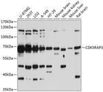 CDK5RAP3 Antibody in Western Blot (WB)