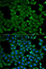 ATL1 Antibody in Immunocytochemistry (ICC/IF)