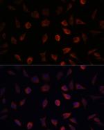 FABP1 Antibody in Immunocytochemistry (ICC/IF)