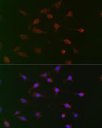 CDC34 Antibody in Immunocytochemistry (ICC/IF)