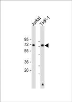 SQSTM1 Antibody in Western Blot (WB)