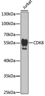 CDK8 Antibody in Western Blot (WB)