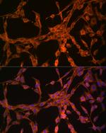 TK1 Antibody in Immunocytochemistry (ICC/IF)