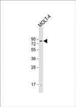 HRD1 Antibody in Western Blot (WB)