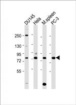 HRD1 Antibody in Western Blot (WB)