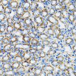 alpha Catenin Antibody in Immunohistochemistry (Paraffin) (IHC (P))